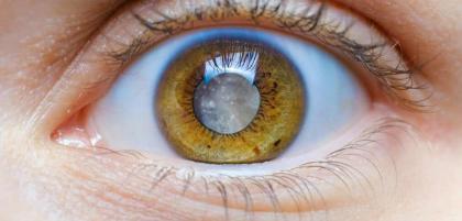 Jak wygląda leczenie zaćmy?