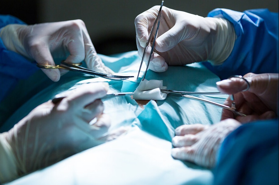 Operacje plastyki przepuklin brzusznych oraz pachwinowych
